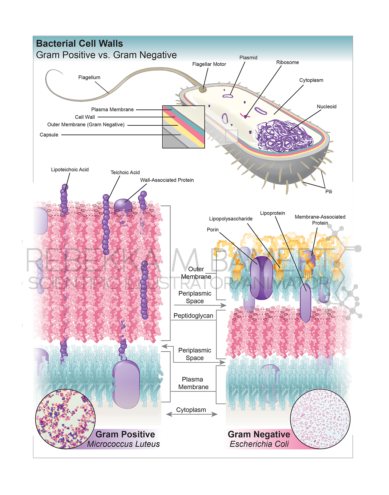 Gram Positive Vs Gram Negative Cell Wall